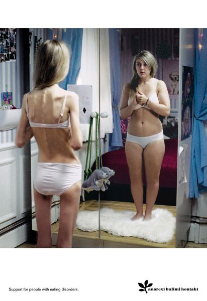 Файл:Anorexia.jpg